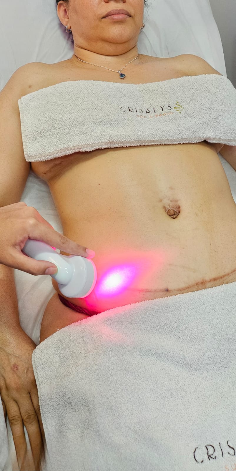 Laser no Pós-Operatório: Acelerando a Recuperação com Tecnologia de Ponta na Estética Crisalys