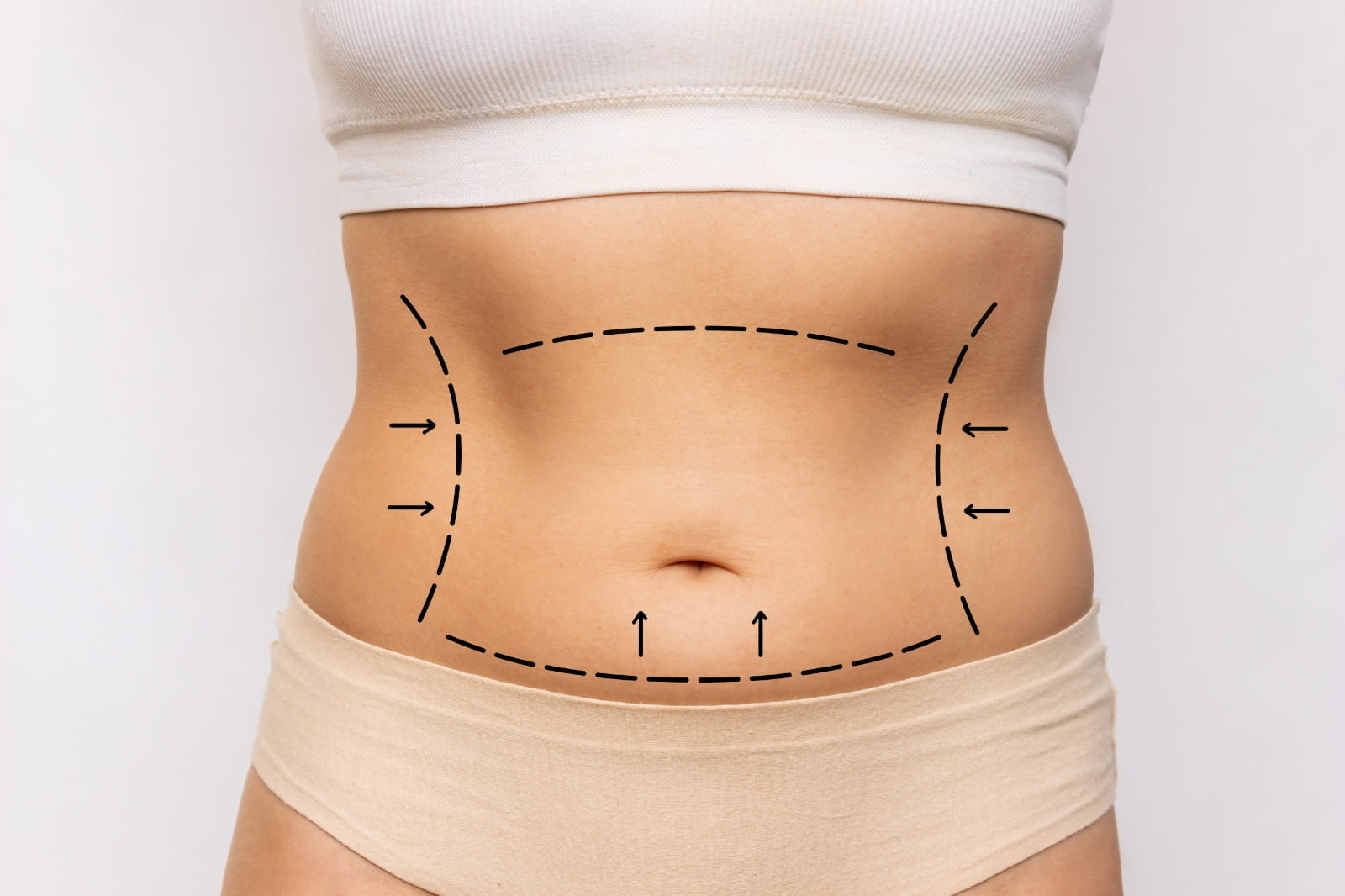 A Importância do Repouso e Tratamento Pós-Operatório Após a Abdominoplastia: Diretrizes da Estética Crisalys