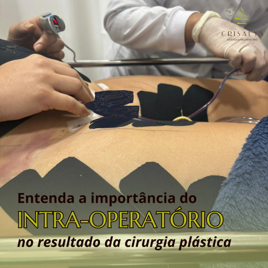 Benefícios do Intra Operatório: O Que Você Precisa Saber - Blog ...