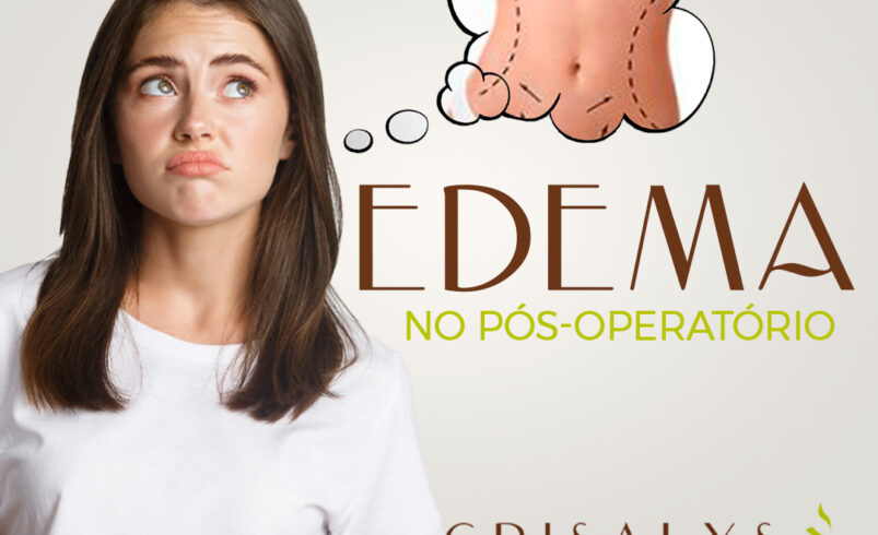 Edema no Pós-Operatório: Quando se Preocupar e Procurar Ajuda Médica?