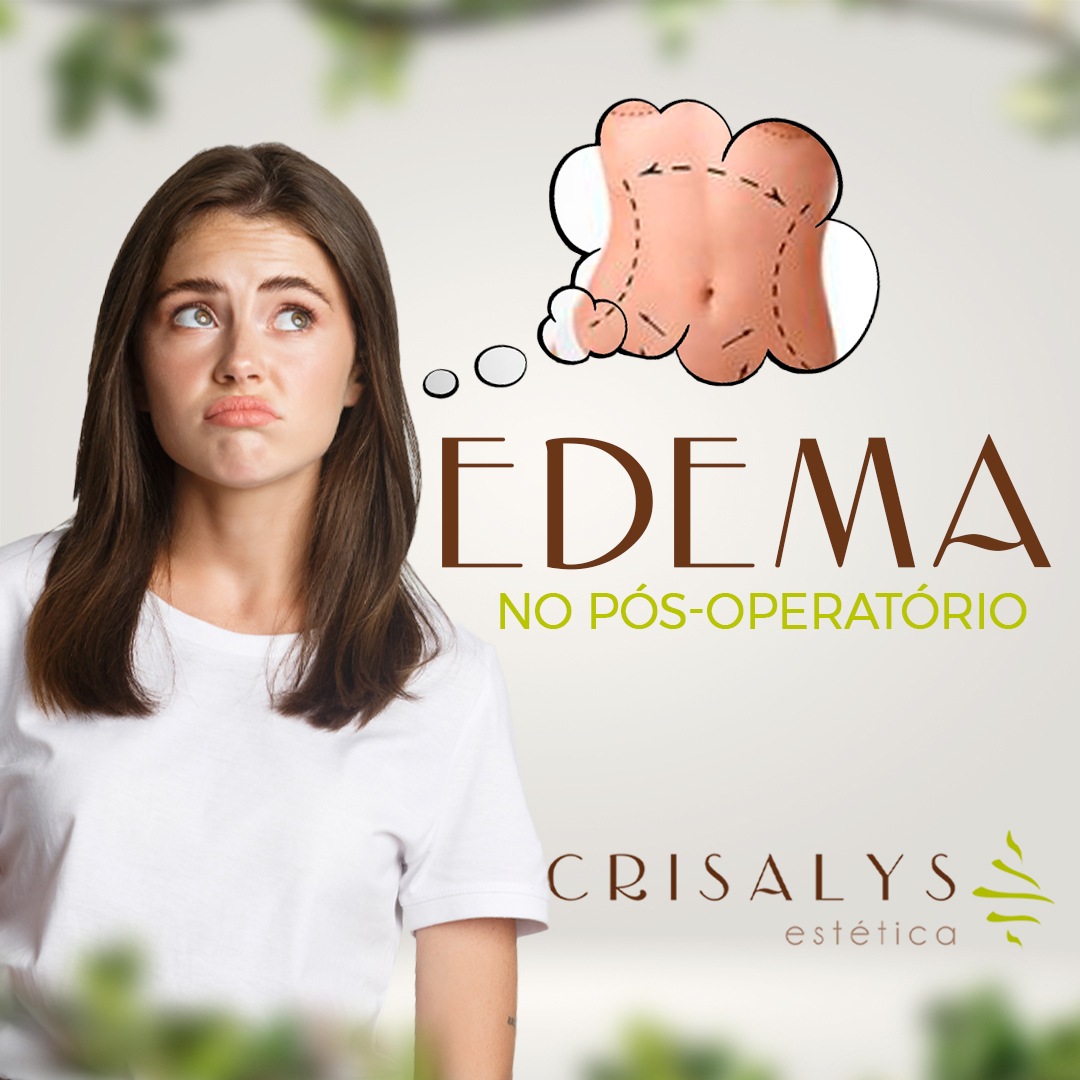 edema-no-pos-operatorio