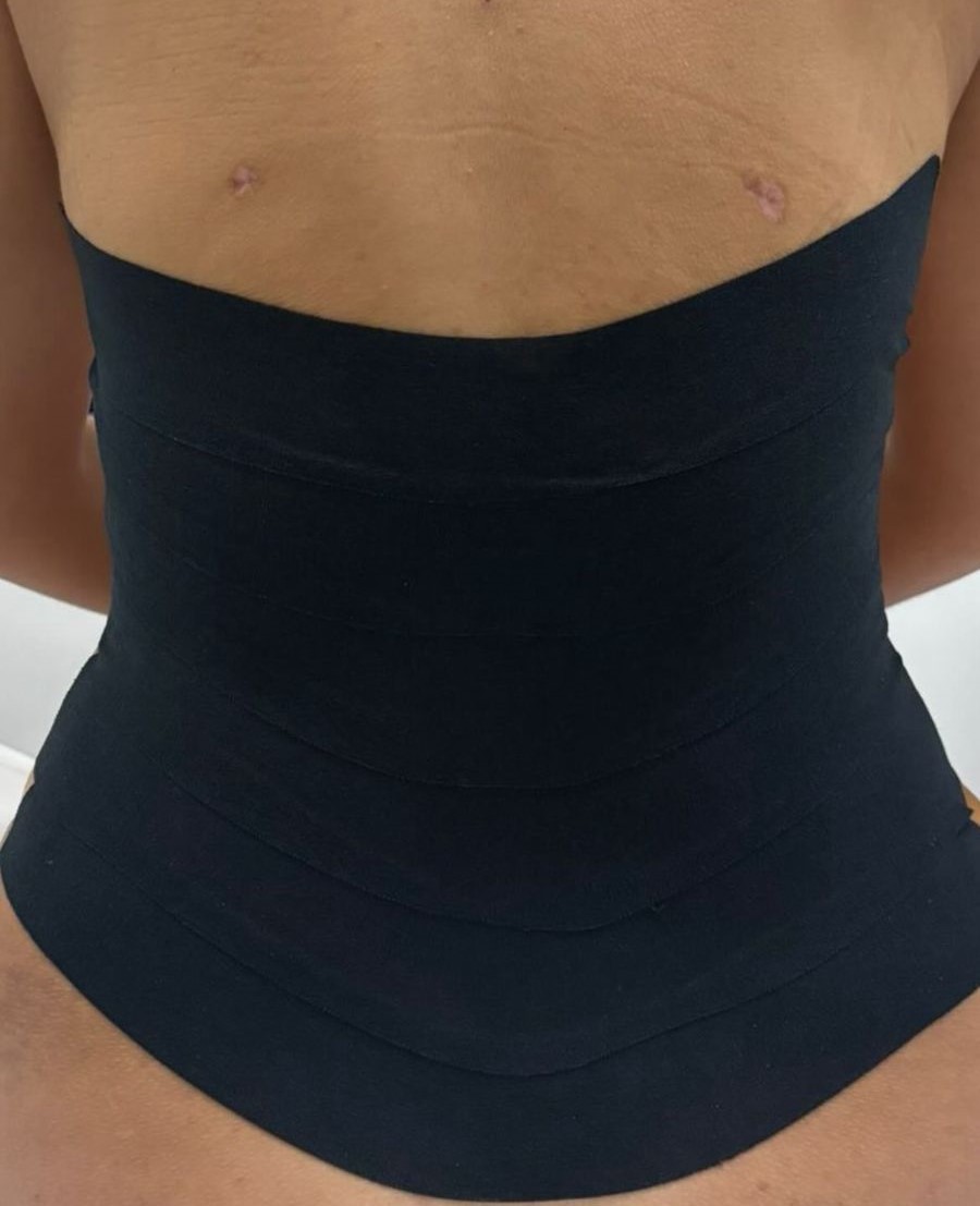 estetica-pos-operatorio-cirurgia-plastica-corporal-e-efacial-santo-andre-abc-paulista-crisalys-estetica